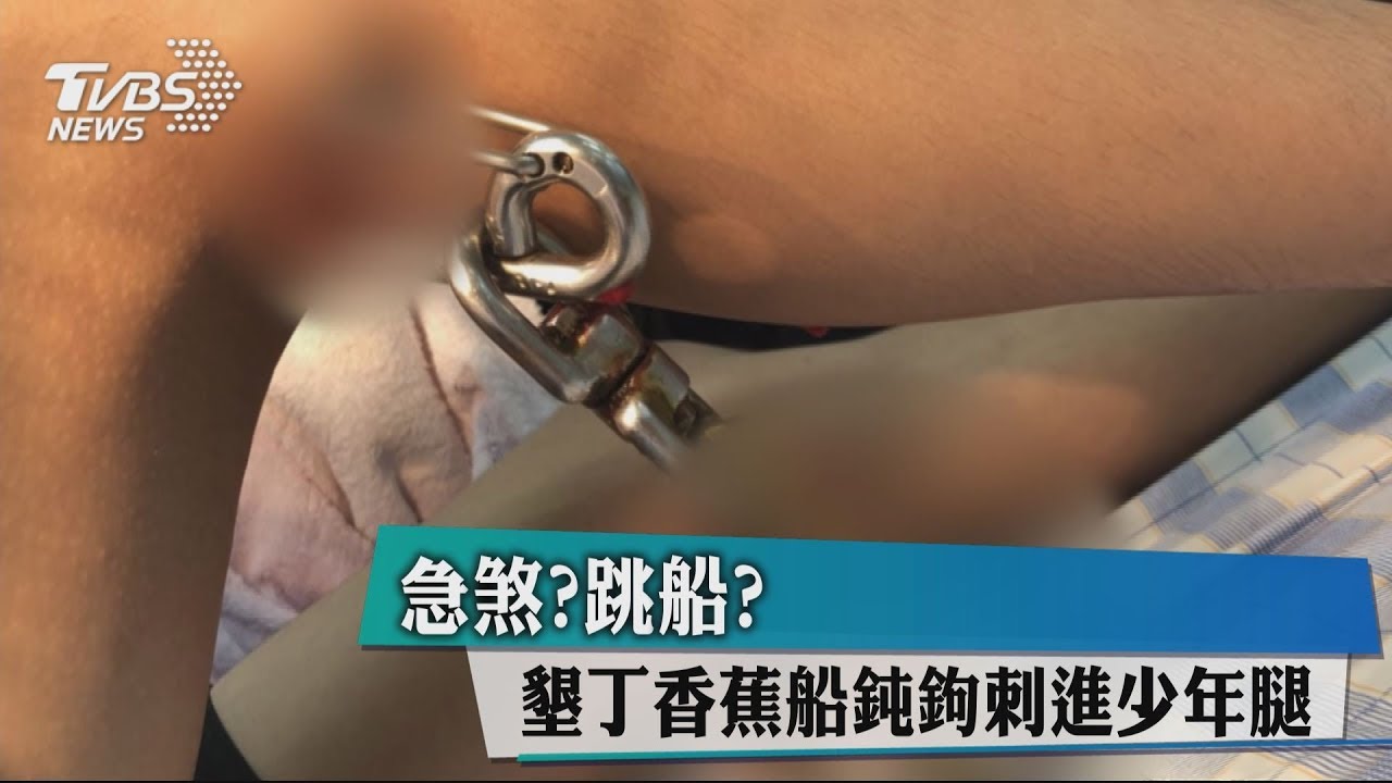 急煞?跳船? 墾丁香蕉船鈍鉤刺進少年腿