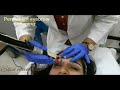 Eyebrow Threading Permanent Hair Removal