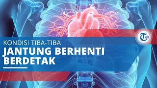 Serangan Jantung, Terjadi karena Sumbatan Kolestrol di Arteri Koroner