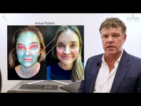 Blepharoplasty Recovery Guide & Timeline by Dr. Ennis