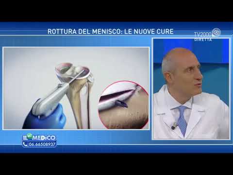 Quali cibi dovrebbe essere limitata alle malattie delle articolazioni Complicazione del mal di schiena