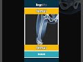 femur - fémur video thumbnail