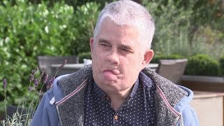 Blood infection causes man to lose his limbs and face