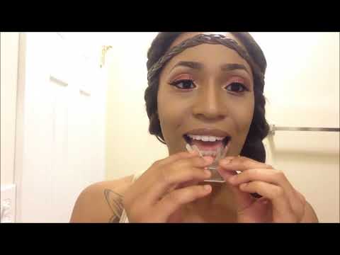 Teeth Whitening From TheSmileLight.com