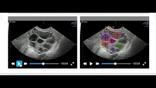 Coastal Fertility Announces Cycle Clarity!