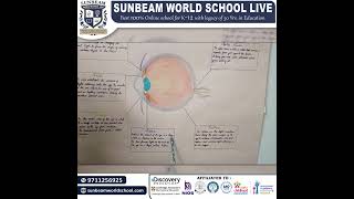 “Understanding the Human Eye: A Student’s Guide from Sunbeam World School”👁️