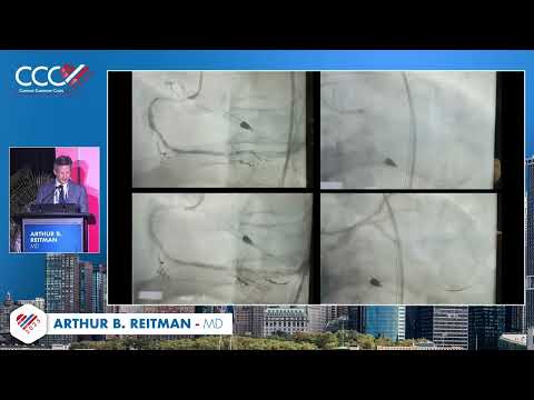 Arthur B  Reitman, MD   Case #3  My Worst PCI Complication