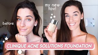 Natural Looking Foundation for Acne | CLINIQUE ACNE SOLUTIONS FOUNDATION REVIEW + DEMO