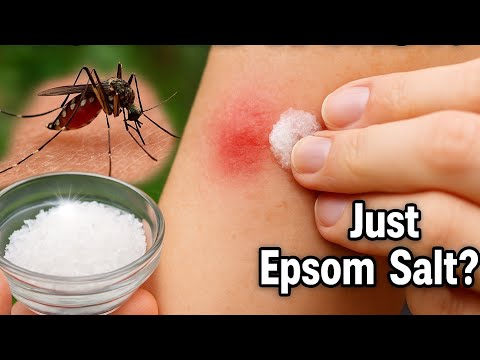 Soothe Bug Bites FAST With Epsom Salt!🤫