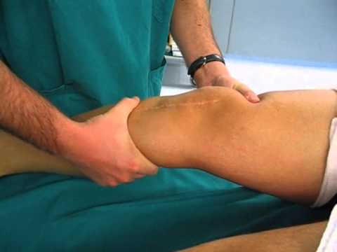 Trattamento astratto di osteoartrite Artrosi deformante di primo grado dellanca