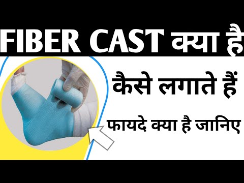 Fiber Cast Application And it's Benefits || फाइबर कास्ट क्या है और इसको कैसे लगाया जाता है, plaster