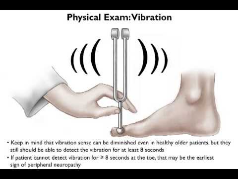 Brief Physical Examination for Peripheral Neuropathy