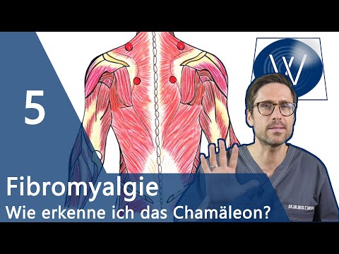 Fibromyalgie: 5 sichere Anzeichen, dass Sie am Fibromyalgie Syndrom (FMS) erkrankt sind!