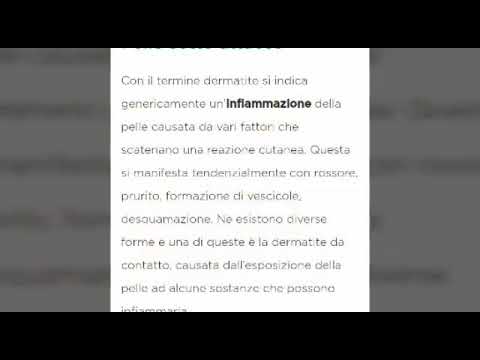 Cura di ulcere ed eczemi Eczema su appezzamenti di mani