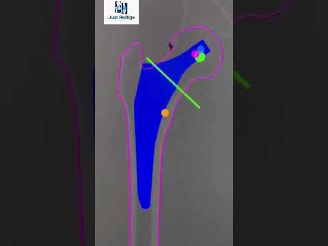 video xCmBX-hfuMs