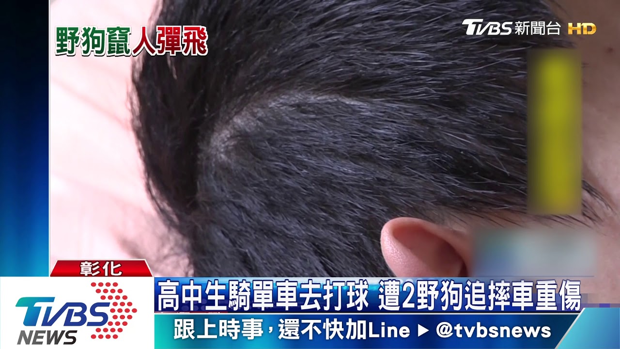 高中生騎單車去打球　遭2野狗追摔車重傷