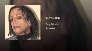 Its This Itch