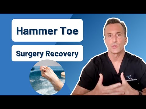 How Long Is Recovery From Hammer Toe Surgery?