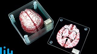 BRAIN COASTERS -- LÜT #57