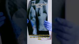 A descoberta do Raio X #shorts #medicina