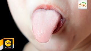 ¿Por qué tu hijo puede tener la lengua blanca│RPP