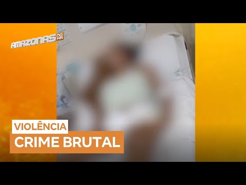 Jovem de 17 anos segue em estado vegetativo em Itacoatiara (AM) após crime violento no réveillon