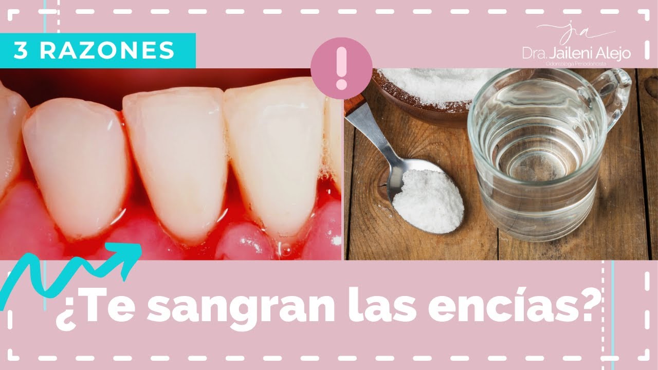 Watch ENCIAS SANGRANTES E INFLAMADAS Now ENCIAS SANGRANTES E INFLAMADAS