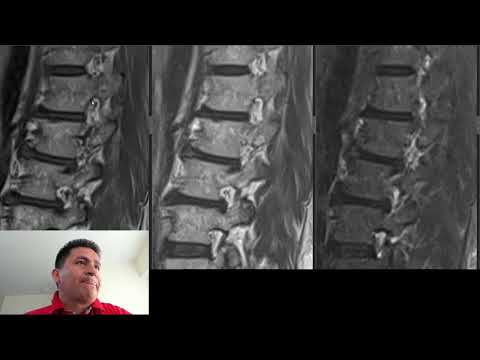David Tafur Muñoz-3531