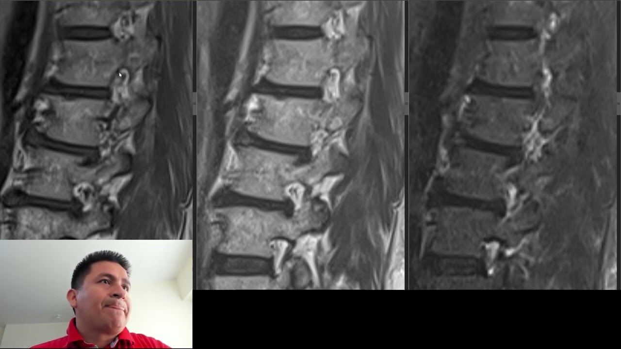 David Tafur Muñoz-2465