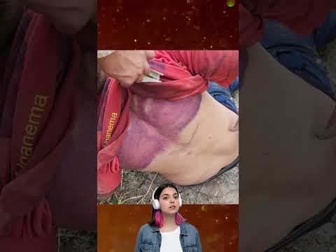 O motorista por aplicativo sofreu agressões e foi salvo por policiais civis.