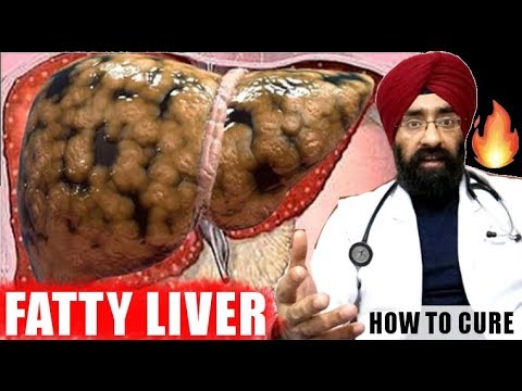 Reversing FATTY LIVER DISEASE, NAFLD & NASH Explained (in ENG) by Dr.Education Video
