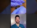 Giant cyst!!! #pimplepopping dermdoctor #shorts