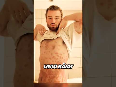 🧲🧻 Cea Mai Dureroasă Farsă Din Lume!