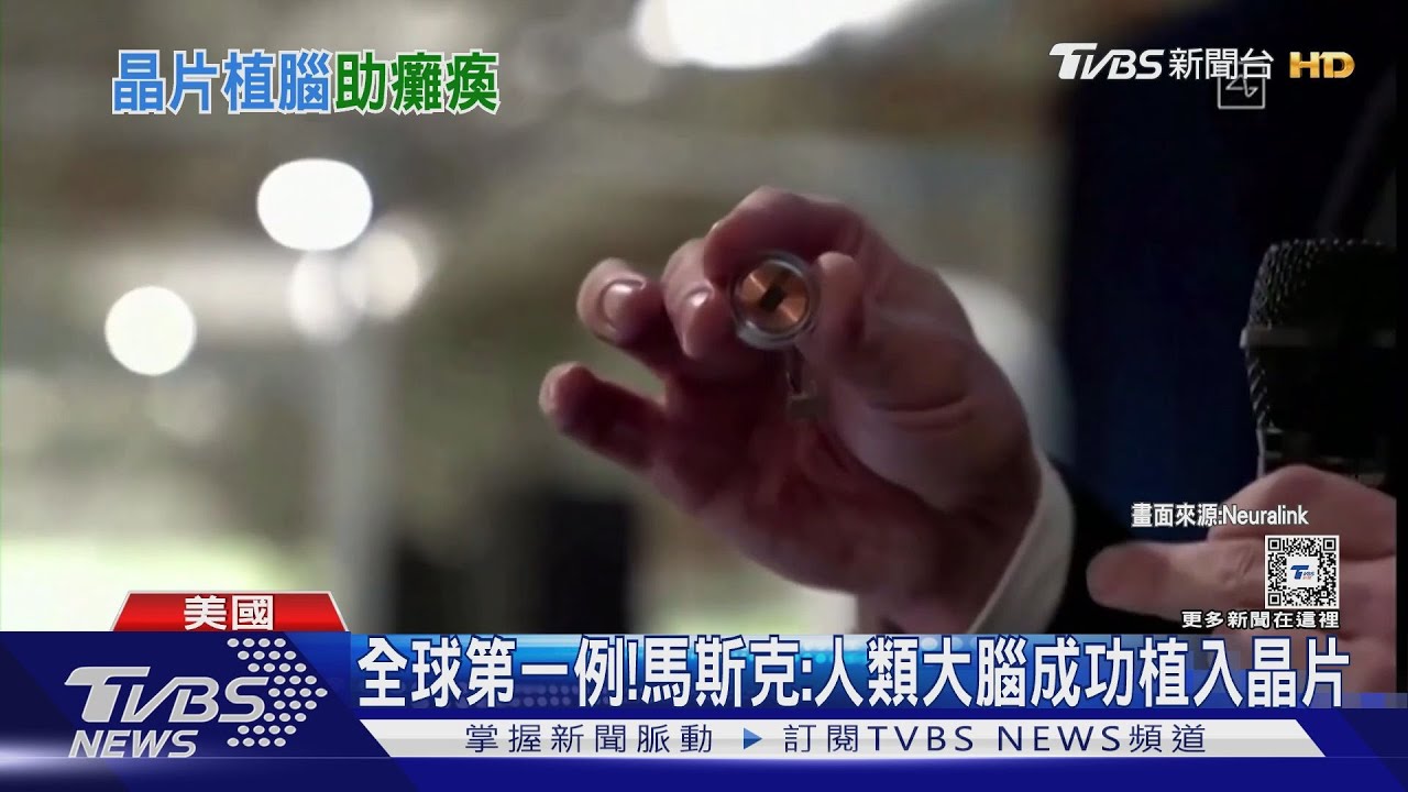 全球首例!馬斯克X平台宣布 人類大腦成功植入晶片