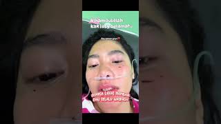 Download lagu Kondisi kak lusiana jelita dan mobilnya setelah terjadi laka lantas #lusiana mp3 Download lagu Kondisi kak lusiana jelita dan mobilnya setelah terjadi laka lantas #lusiana mp3