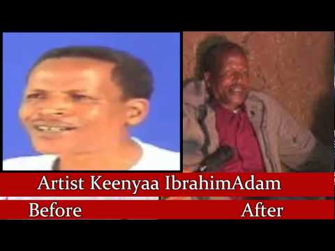 Oromia:Artist Keenyaa Ibrahim Adam On GoFundMe.Com 7/2015