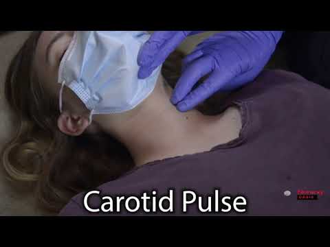 how to check carotid pulse