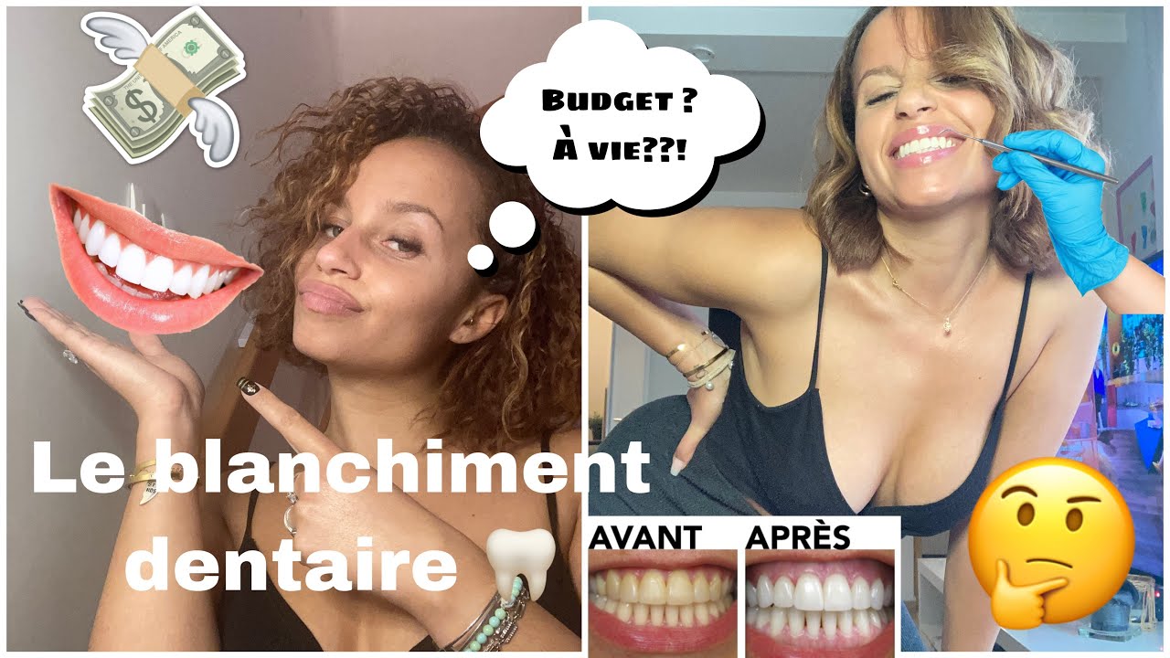 Watch video BLANCHIMENT DENTAIRE: MON EXPERIENCE, PRIX, DOULEUR ! ???? BLANCHIMENT DENTAIRE: MON EXPERIENCE, PRIX, DOULEUR ! ????