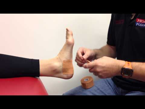 Taping For Heel Pain
