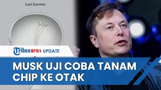 Elon Musk akan Lakukan Uji Coba Tanam Chip ke Otak Manusia, Sebut Dapat Lampu Hijau Pengujian