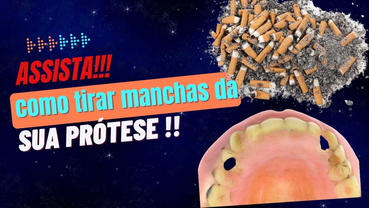 COMO TIRAR MANCHA DE CIGARRO DA PRÓTESE E DENTADURA?