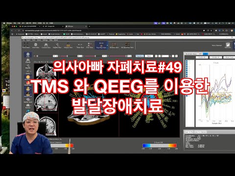 TMS와 qEEG를 이용한 발달장애 치료