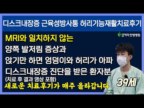 치료후기사진 입니다.