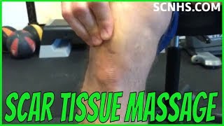 Self Scar Tissue Massage | Post Surgery Treatment