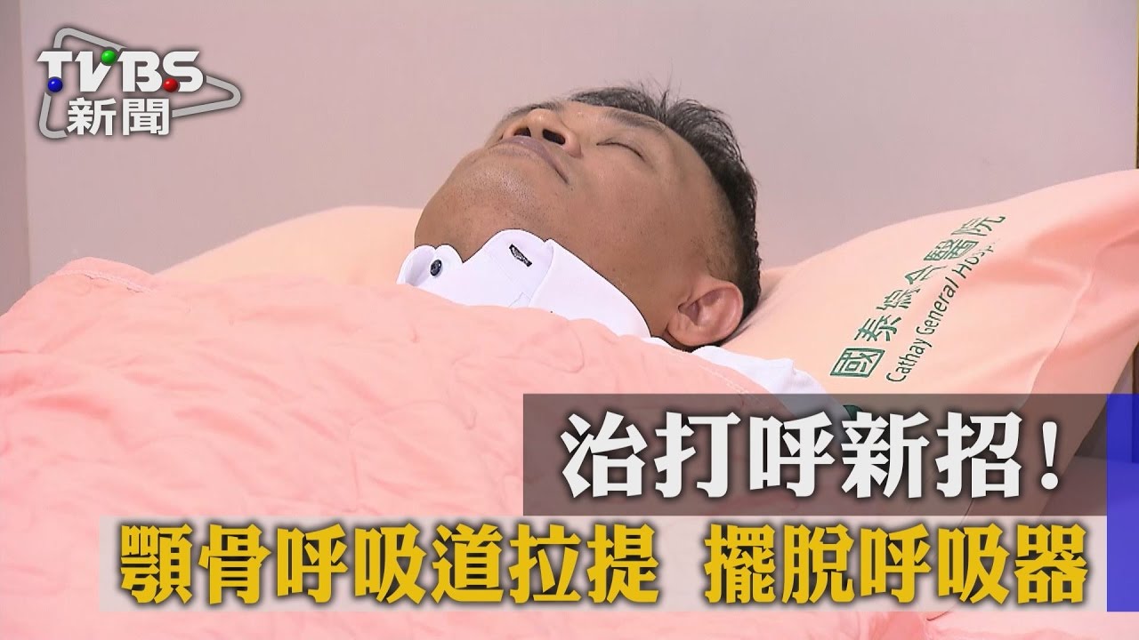 治打呼新招!顎骨呼吸道拉提 擺脫呼吸器