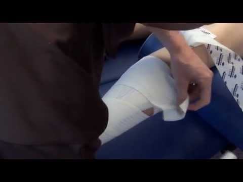 comment soigner tendon d'achille
