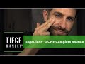 Level 3 The TiegeClear ACNE Complete Routine