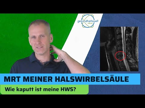 Herniated disc in the cervical spine? My images explained simply.