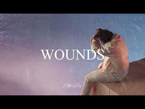[FREE] Lewis Capaldi x Piano Ballad Type Beat - "Wounds"