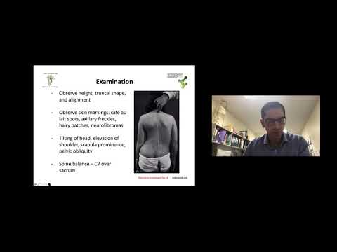 Paediatric spinal deformity